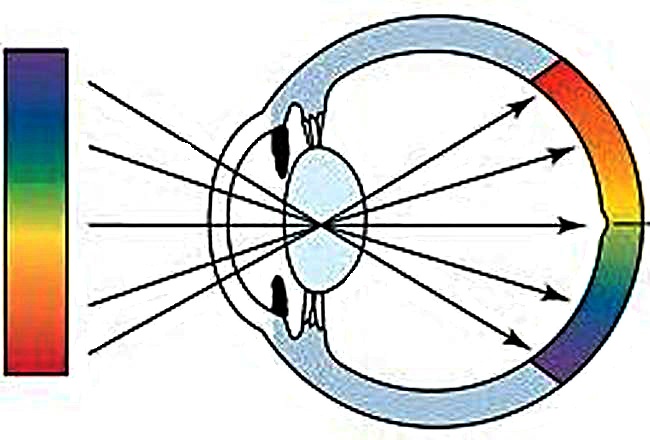 Схема рефракции глаза